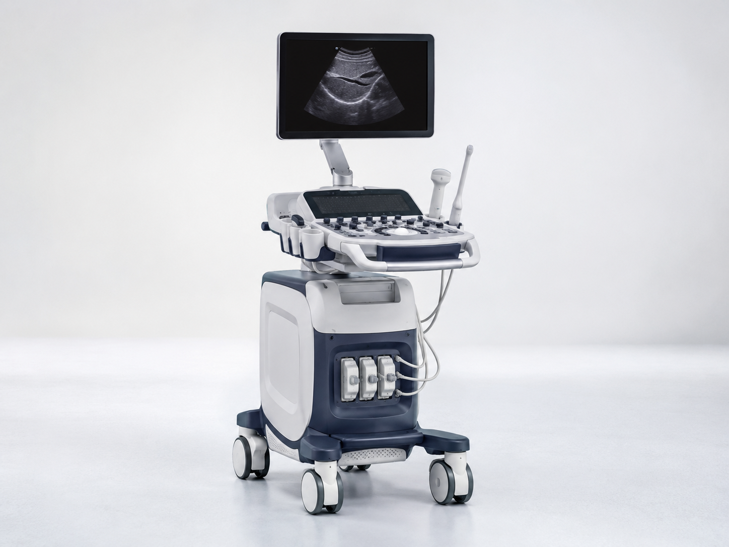 AI-Guided Ultrasound equipment